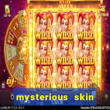 mysterious skin online dublado