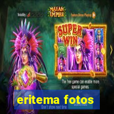 eritema fotos